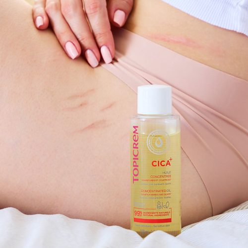 ⁦Cica Conc Stretch & Skin Mask oil 100ml⁩ - الصورة ⁦2⁩